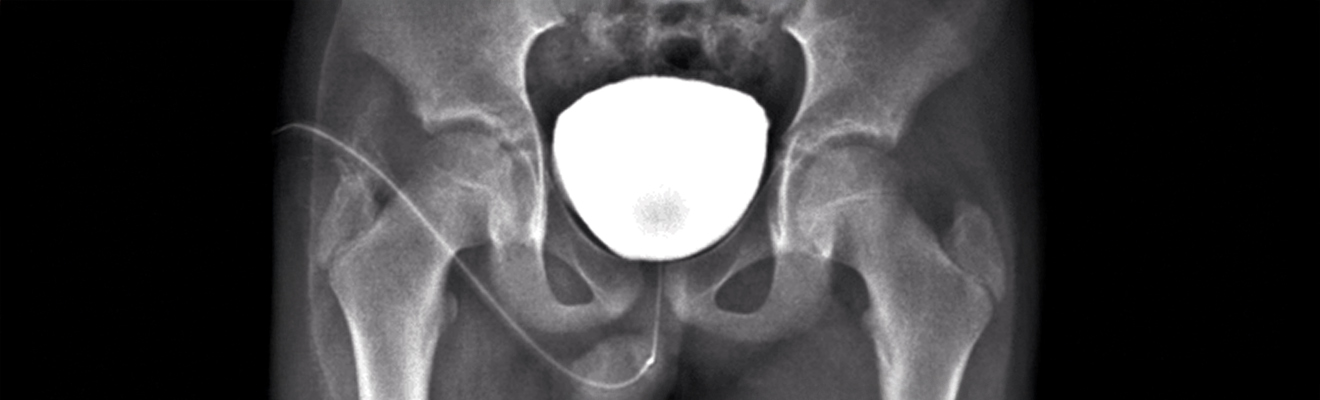 Urologiya